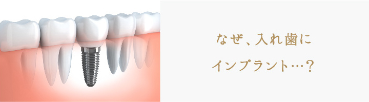 なぜ、入れ歯にインプラント…?